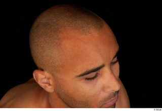 Aaron bald hair 0008.jpg